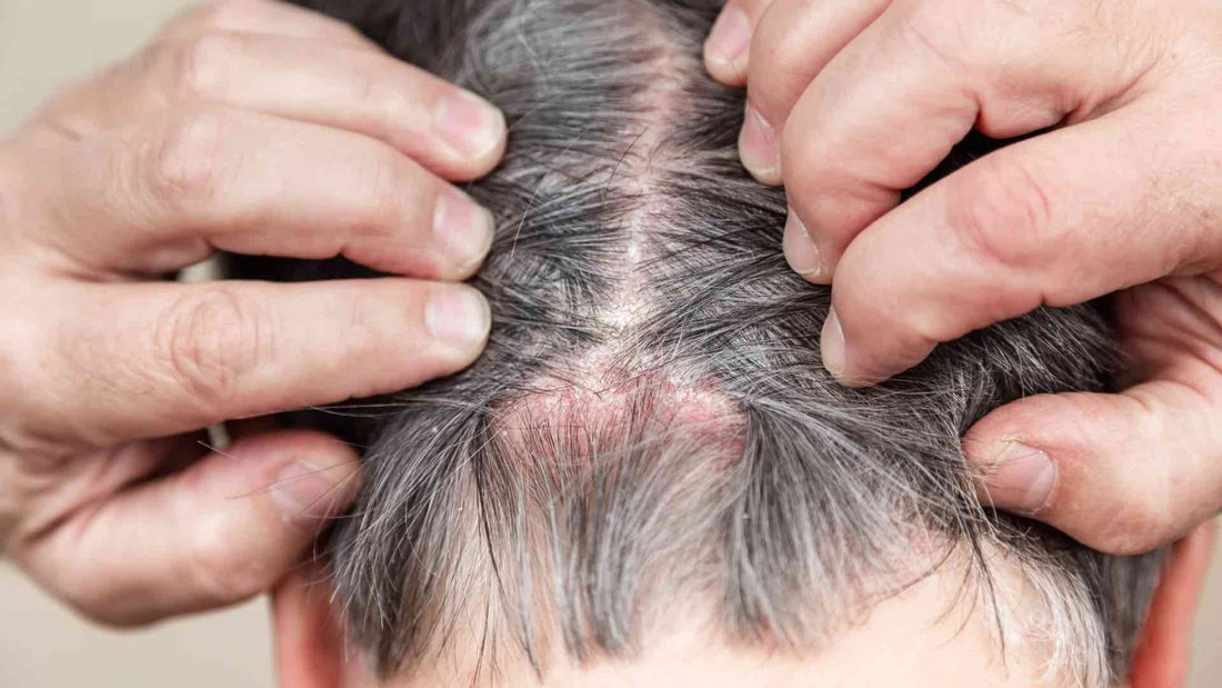persona affetta da malattia cutanea